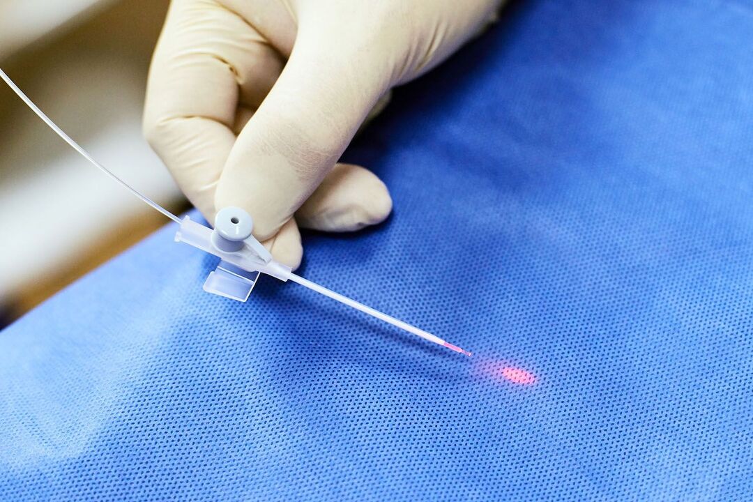 dispositivo transrectal para o tratamento da próstata